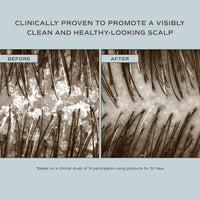 Scalp close-up photos labelled before and after, Innersense Hair Renew Scalp Hairbath
