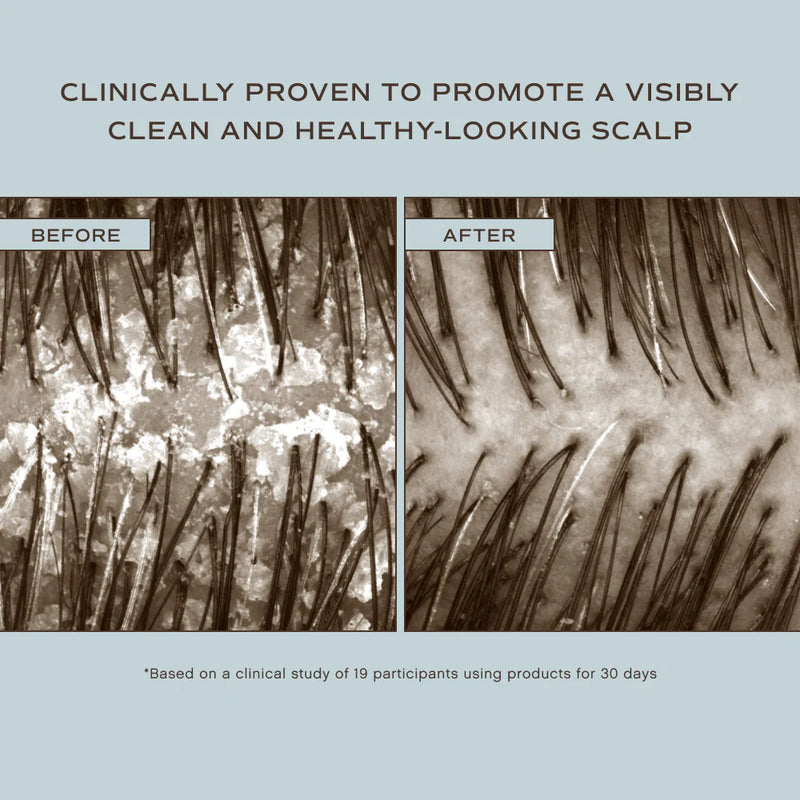Scalp close-up photos labelled before and after, Innersense Hair Renew Scalp Hairbath
